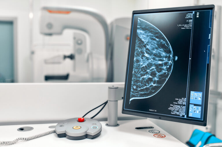 Mammography machine and images on computer screen