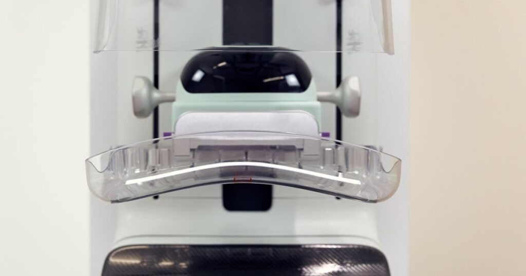 SmartCurve® Breast Stabilization System for Annual Screening Mammograms